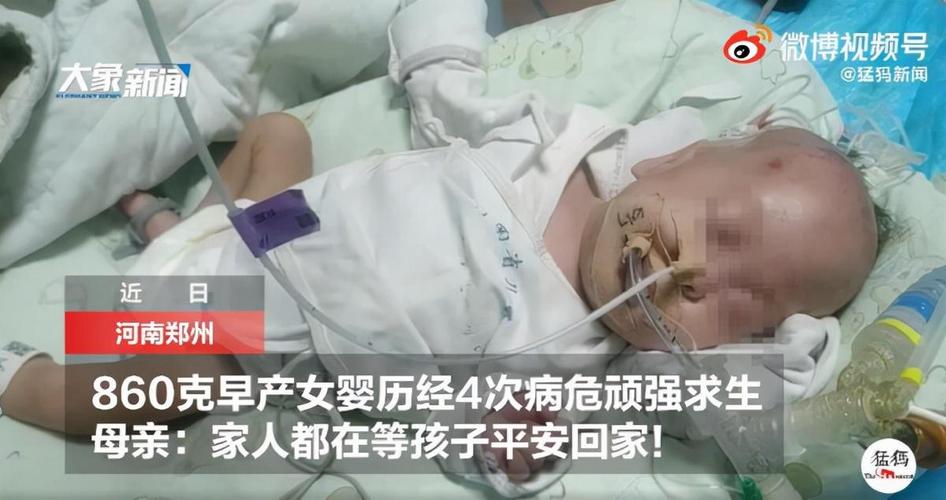 新澳门彩出码走势和台早产女婴术后瘫痪与早产儿手术后度过危险期