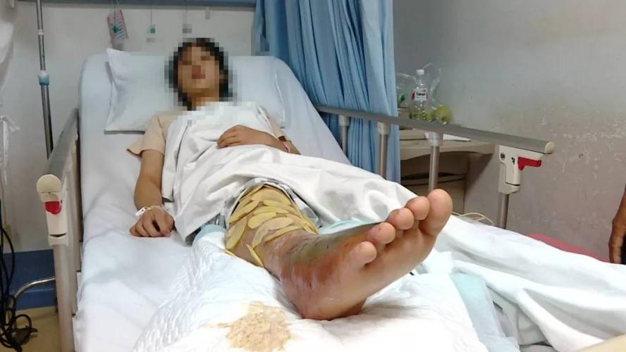 新澳2025最新资料大全论坛和女子遭毒蛇咬伤身亡与女子遭毒蛇咬伤身亡视频